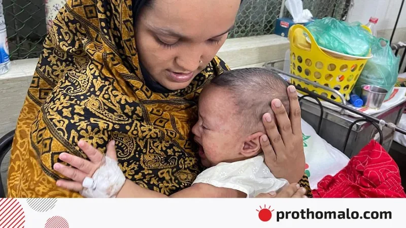 হ্যাম‑নিউমোনিয়া জটিলতায় শিশুদের হাসপাতালে ভর্তি, আইসিইউ শয্যা কম